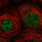 Immunofluorescent staining of human cell line A-431 shows localization to nucleoplasm.