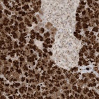 Anti-C21orf58 Antibody