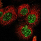 Immunofluorescent staining of human cell line A-431 shows localization to nucleoplasm & nuclear bodies.