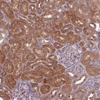 Anti-IGF2BP2 Antibody