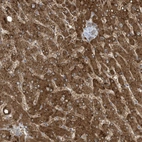 Anti-ADI1 Antibody