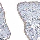 Immunohistochemical staining of human Fallopian tube shows moderate membranous positivity in glandular cells.