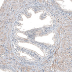 Immunohistochemical staining of human prostate shows moderate membranous positivity in glandular cells and weak cytoplasmic staining of smooth muscle cells.