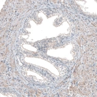 Immunohistochemical staining of human prostate shows moderate membranous positivity in glandular cells and weak cytoplasmic staining of smooth muscle cells.