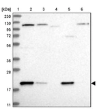 Lane 1: Marker [kDa] 230, 130, 95, 72, 56, 36, 28, 17, 11_br/_Lane 2: Human cell line RT-4_br/_Lane 3: Human cell line U-251MG sp_br/_Lane 4: Human plasma (IgG/HSA depleted)_br/_Lane 5: Human liver tissue_br/_Lane 6: Human tonsil tissue