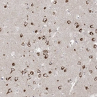 Anti-MARS2 Antibody