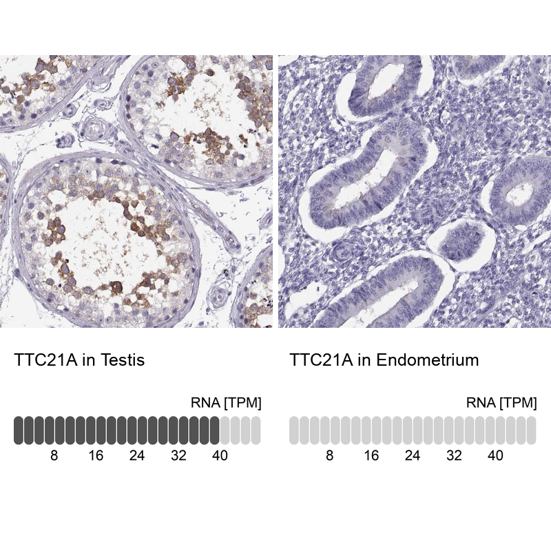 Anti-TTC21A Antibody