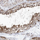 Anti-PCDHA2 Antibody