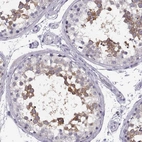 Immunohistochemical staining of human testis shows high expression.