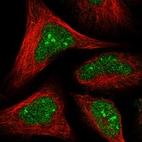 Immunofluorescent staining of human cell line U-2 OS shows localization to nucleus & nucleoli.