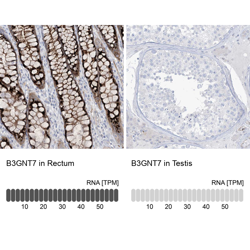 Anti-B3GNT7 Antibody