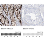 Anti-B3GNT7 Antibody