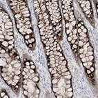 Immunohistochemical staining of human rectum shows strong granular cytoplasmic positivity in glandular cells.