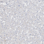 Immunohistochemical staining of human liver shows no positivity in hepatocytes as expected.