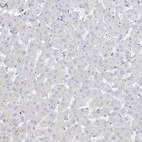 Anti-B3GNT7 Antibody