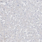 Immunohistochemical staining of human liver shows no positivity in hepatocytes as expected.