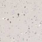 Immunohistochemical staining of human cerebral cortex shows weak to moderate cytoplasmic positivity in neurons.