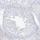 Immunohistochemical staining of human testis shows no positivity in cells in seminiferous ducts as expected.