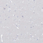 Immunohistochemical staining of human cerebral cortex shows no positivity in neurons as expected.
