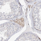 Immunohistochemical staining of human testis shows moderate cytoplasmic positivity in Leydig cells.