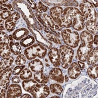 Anti-IFT80 Antibody