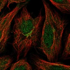 Immunofluorescent staining of human cell line SiHa shows localization to nucleoplasm & the Golgi apparatus.