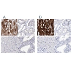 Immunohistochemical staining of human heart muscle, kidney, liver and prostate using Anti-MYOZ2 antibody HPA035763 (A) shows similar protein distribution across tissues to independent antibody HPA035764 (B).