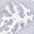 Immunohistochemical staining of human prostate shows low expression as expected.