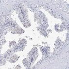 Immunohistochemical staining of human prostate shows low expression as expected.