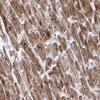 Immunohistochemical staining of human heart muscle shows high expression.