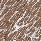 Anti-ZFYVE16 Antibody