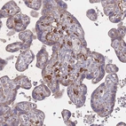 Immunohistochemical staining of human placenta shows moderate positivity in lymphoid cells.