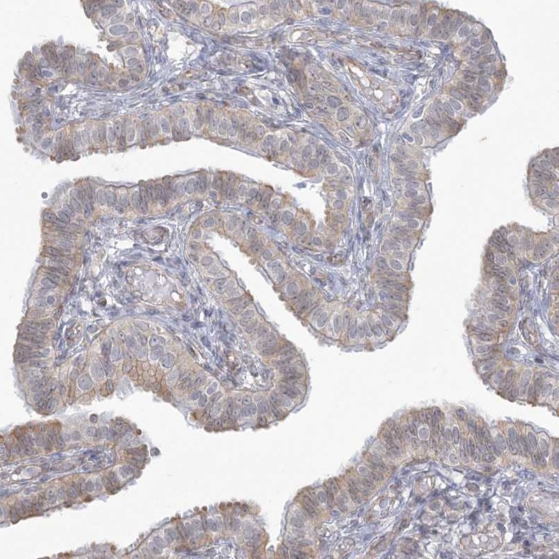 Anti-ZC3H6 Antibody