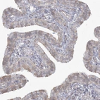 Anti-ZC3H6 Antibody