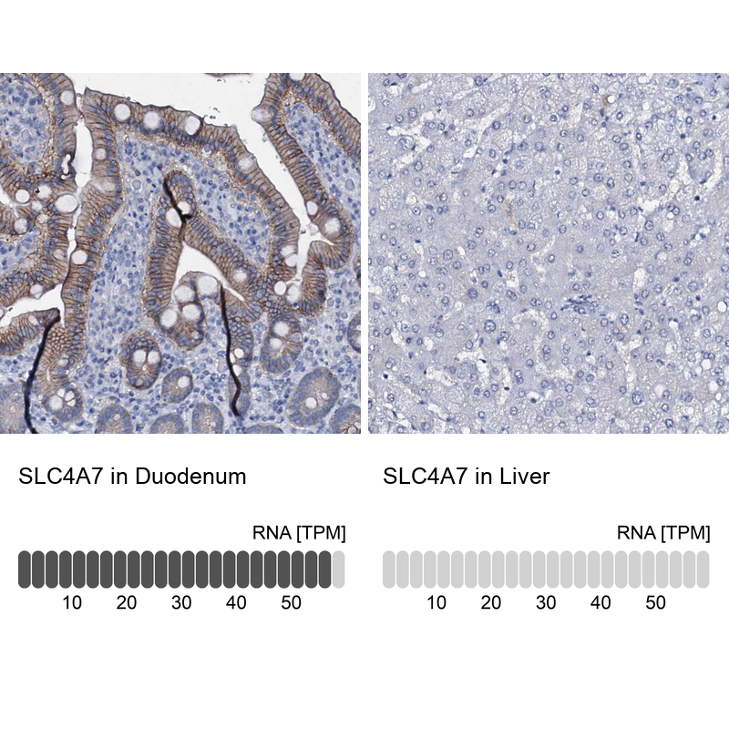 Anti-SLC4A7 Antibody