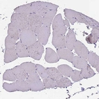Immunohistochemical staining of human skeletal muscle shows no positivity in myocytes as expected.