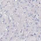 Immunohistochemical staining of human liver using Anti-MYOZ2 antibody HPA035763.