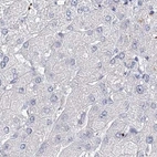 Immunohistochemical staining of human liver using Anti-MYOZ2 antibody HPA035763.