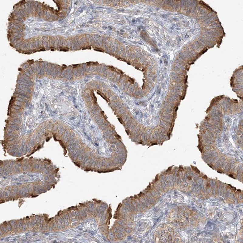 Anti-ZC3H6 Antibody