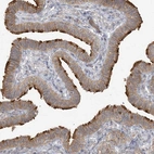 Anti-ZC3H6 Antibody