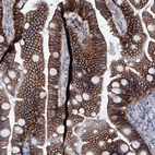 Immunohistochemical staining of human small intestine shows moderate to strong membranous positivity in glandular cells.