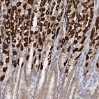 Anti-TTC32 Antibody