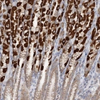 Anti-TTC32 Antibody
