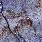 Immunohistochemical staining of human tonsil shows moderate to strong membranous positivity in squamous epithelial cells.