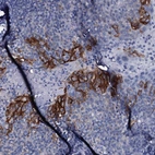 Immunohistochemical staining of human tonsil shows moderate to strong membranous positivity in squamous epithelial cells.