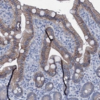 Immunohistochemical staining of human duodenum shows moderate to strong membranous positivity in glandular cells.