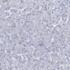 Anti-SLC4A7 Antibody