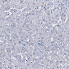 Immunohistochemical staining of human liver shows no positivity in hepatocytes.