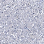 Immunohistochemical staining of human liver shows no positivity in hepatocytes.