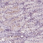 Anti-SLC9A4 Antibody
